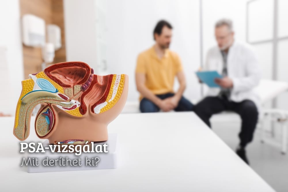 PSA vizsgálat